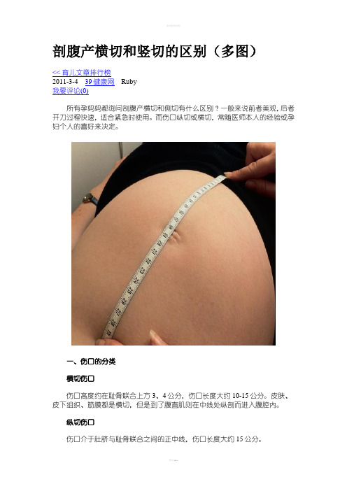 剖腹产横切和竖切的区别