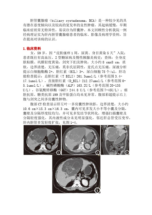 肝内胆管囊腺瘤CT与MRI表现及鉴别