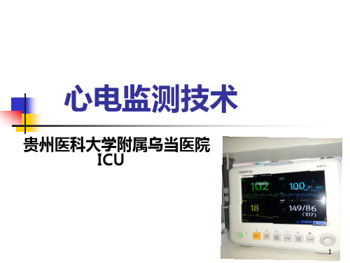 心电监测技术 PPT课件