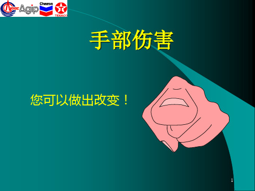 手部安全ppt课件