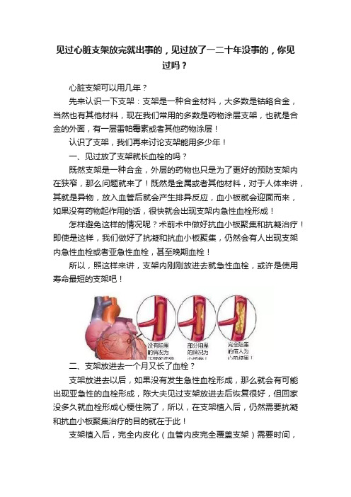 见过心脏支架放完就出事的，见过放了一二十年没事的，你见过吗？