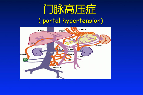 门脉高压症PPT
