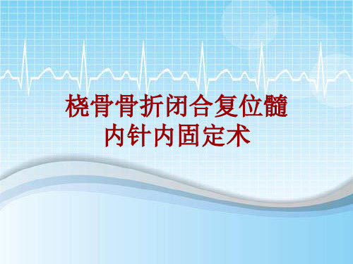 手术讲解模板：桡骨骨折闭合复位髓内针内固定术