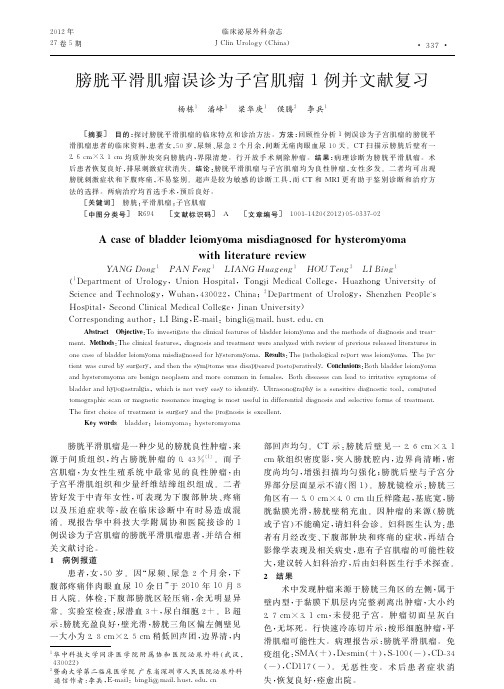膀胱平滑肌瘤误诊为子宫肌瘤1例并文献复习