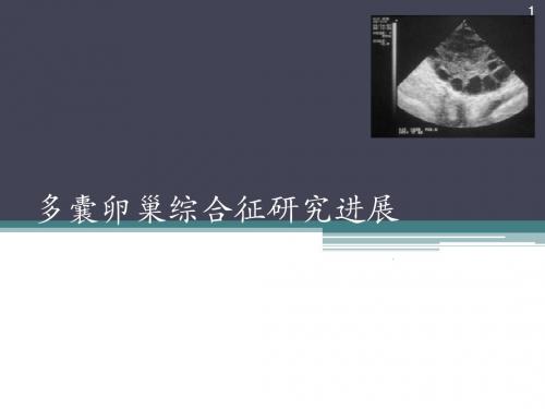 (医学课件)多囊卵巢综合症ppt演示课件