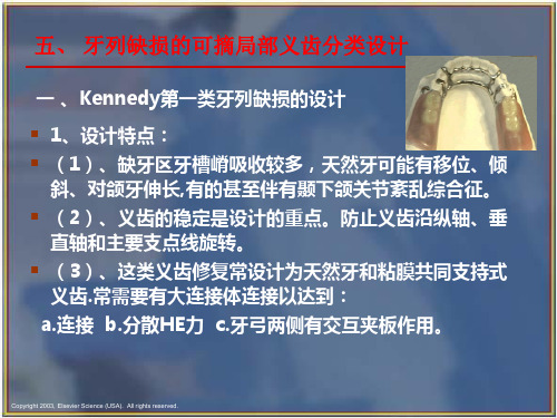 可摘局部义齿的分类设计.优秀精选PPT