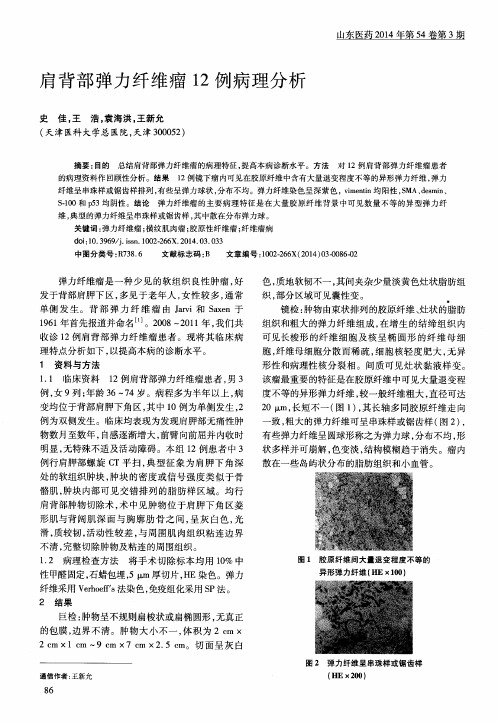肩背部弹力纤维瘤12例病理分析