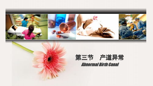 第九版妇产科学_产道异常章节