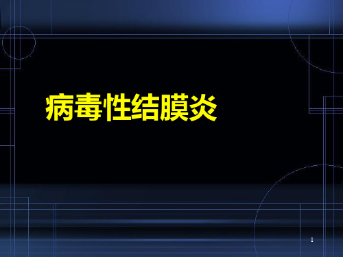 病毒性结膜炎医学PPT课件