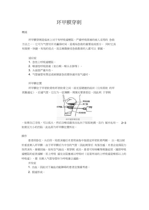 环甲膜穿刺
