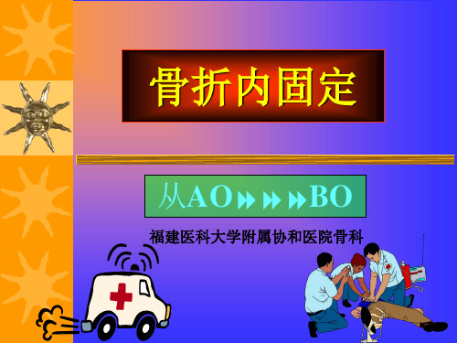 骨折内固定AO-BO