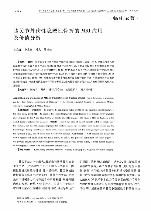 膝关节外伤性隐匿性骨折的MRI应用及价值分析