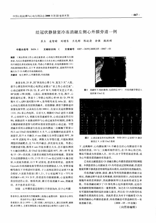 经冠状静脉窦冷冻消融左侧心外膜旁道一例