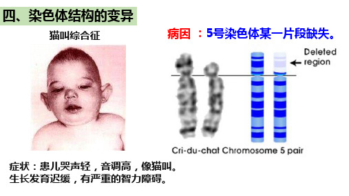 染色体变异第2课时课件高一下学期生物人教版必修2