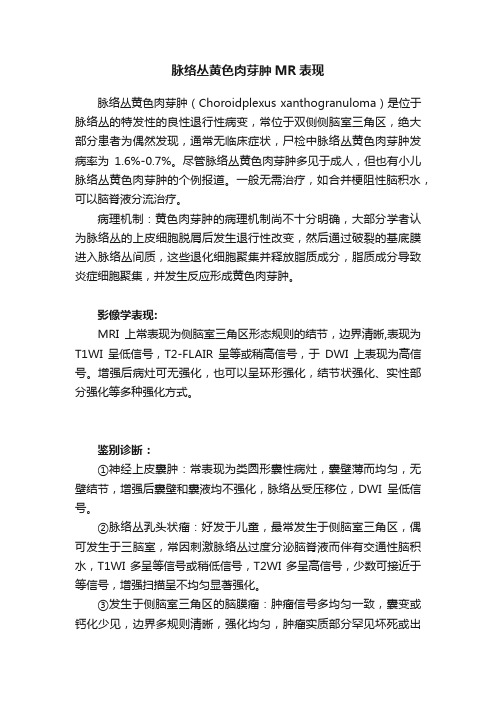 脉络丛黄色肉芽肿MR表现