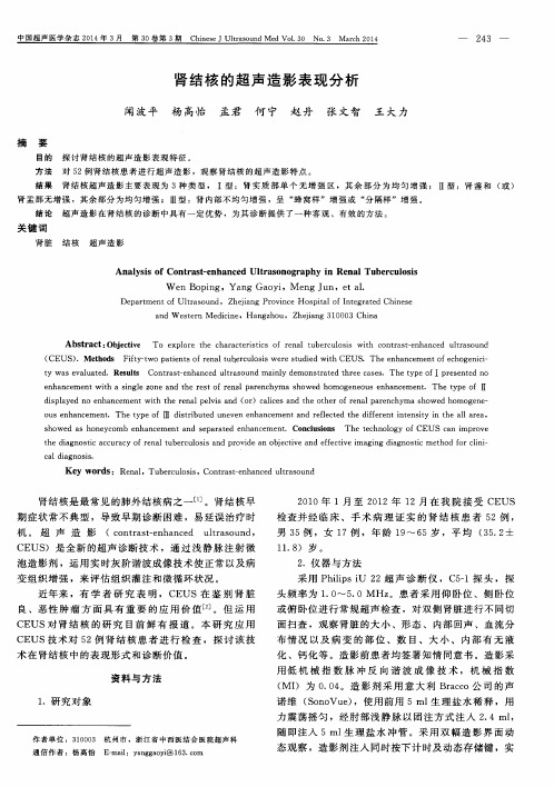 肾结核的超声造影表现分析