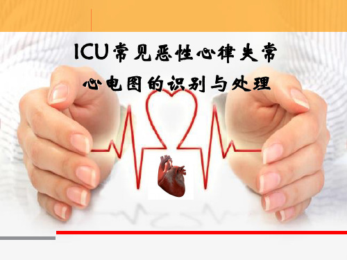 ICU常见恶性心律失常心电图的识别与处理
