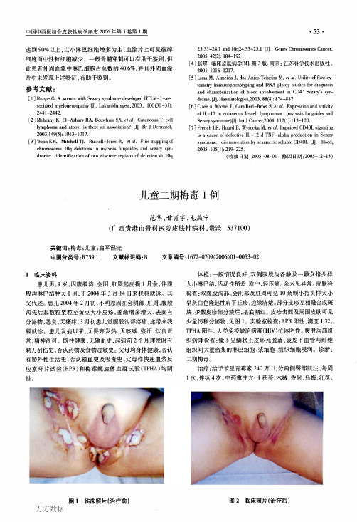 儿童二期梅毒1例(1)