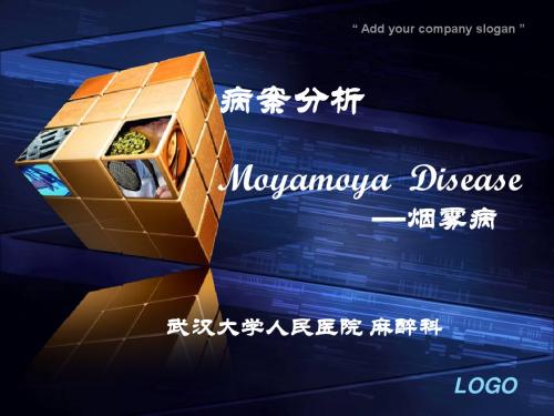 病例分析烟雾病-PPT精选文档