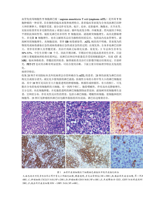 血管免疫母细胞性T淋巴瘤