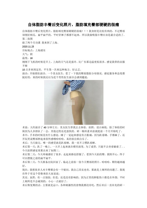 自体脂肪丰臀后变化照片,脂肪填充臀部硬硬的很痛