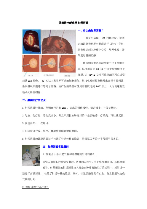 肺癌治疗新选择-射频消融