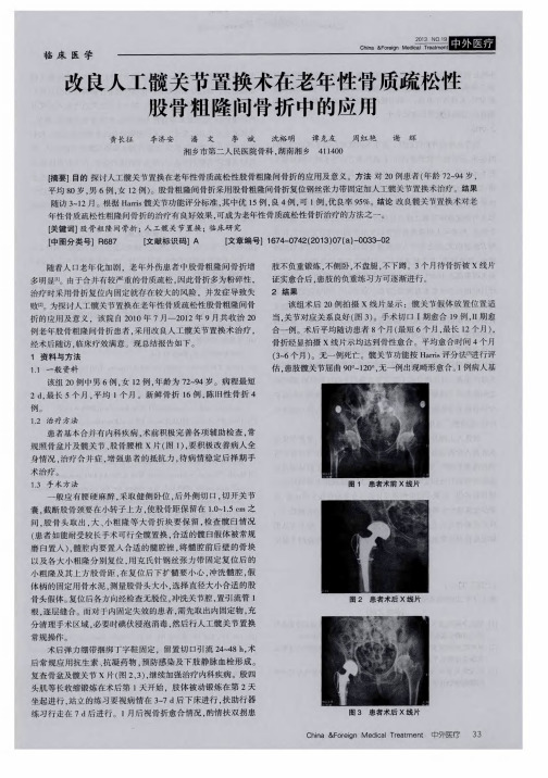 改良人工髋关节置换术在老年性骨质疏松性股骨粗隆间骨折中的应用