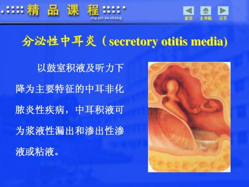 分泌性中耳炎