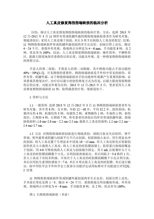 人工真皮修复拇指指端缺损的临床分析