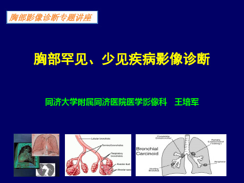 胸部少见、罕见疾病影像诊断