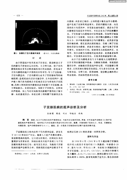 子宫腺肌病的超声诊断及分析