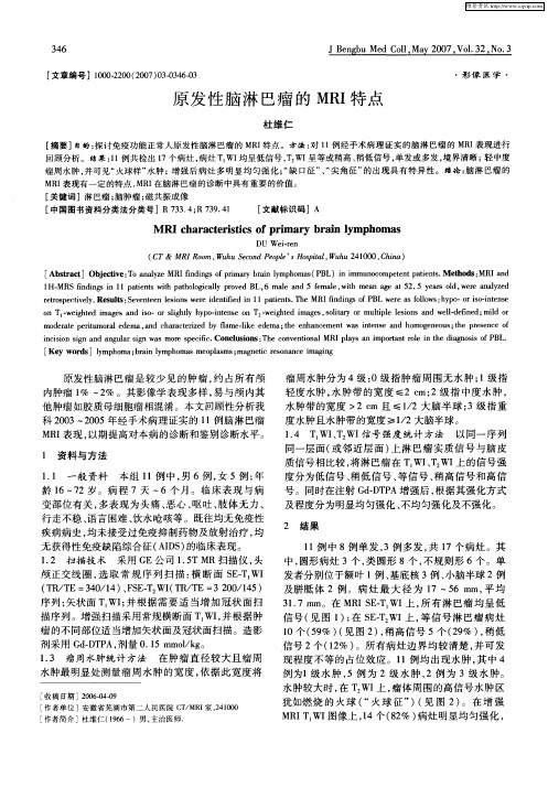 原发性脑淋巴瘤的MRI特点