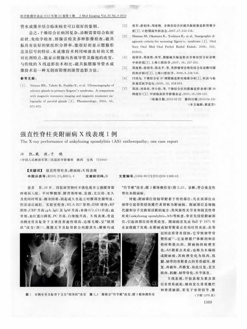 强直性脊柱炎附丽病X线表现1例