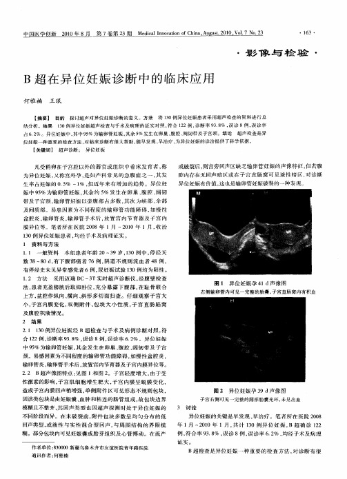 B超在异位妊娠诊断中的临床应用