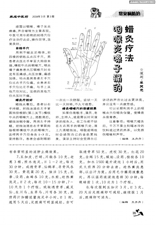 咽喉炎嗓子痛的蜡灸疗法