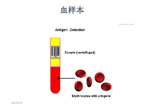 红细胞悬液制备