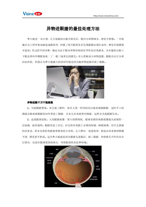 异物进眼睛的最佳处理方法