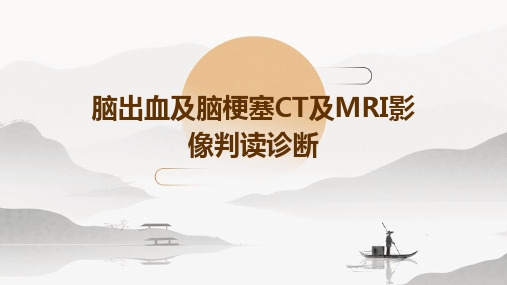 脑出血及脑梗塞CT及MRI影像判读诊断