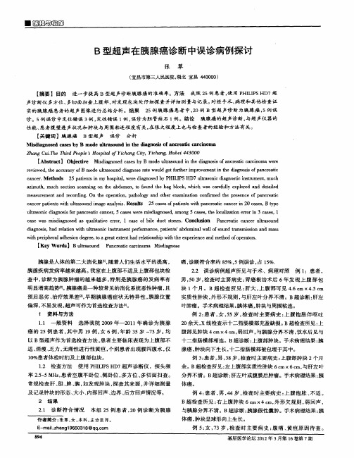 B型超声在胰腺癌诊断中误诊病例探讨