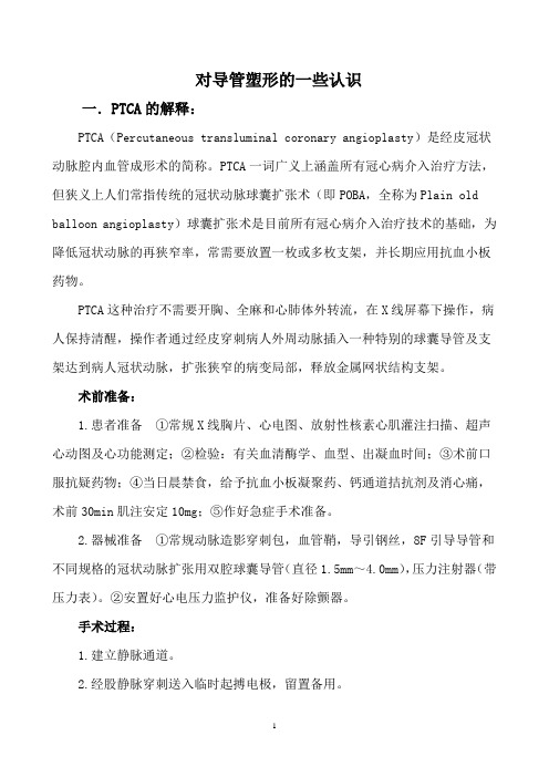 对导管塑形的一些认识