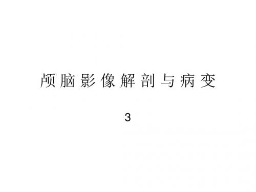 颅脑影像解剖和病变3