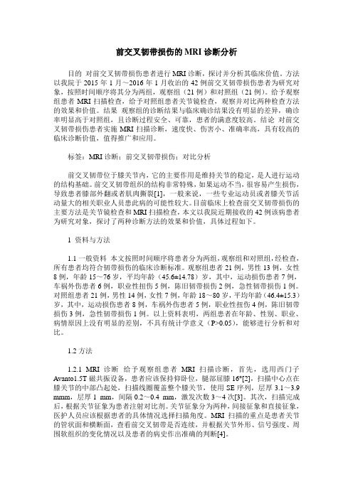 前交叉韧带损伤的MRI诊断分析