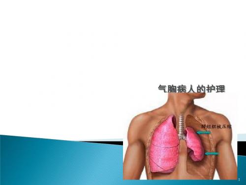 自发性气胸患者的护理ppt课件