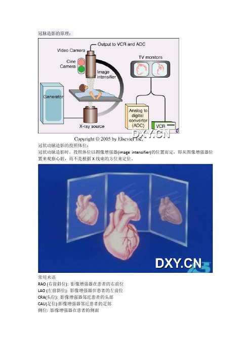 冠脉造影