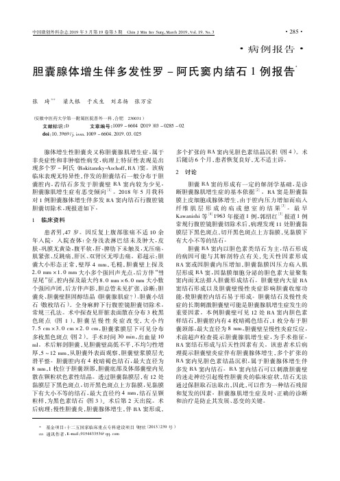胆囊腺体增生伴多发性罗-阿氏窦内结石1例报告