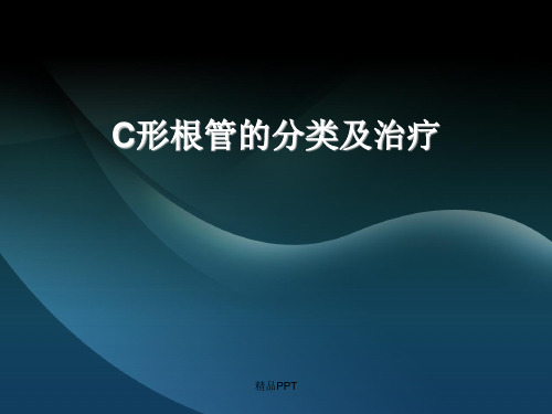 C形根管的分类及治疗