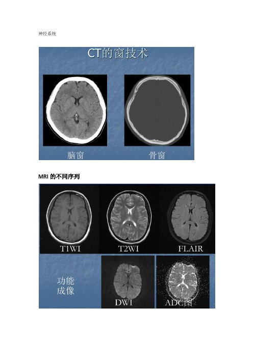 神经系统影像学