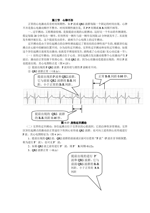 心电图超级学习法3