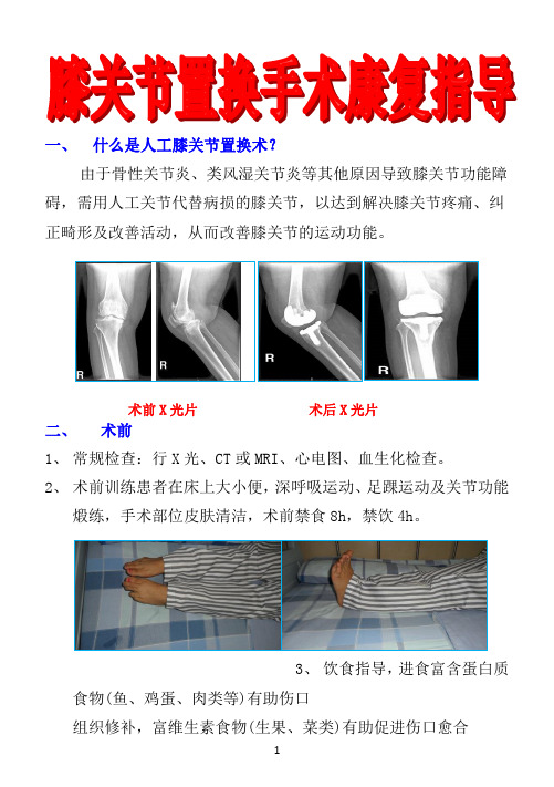膝关节置换手术康复指导1-1