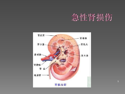 AKI急性肾损伤简介ppt课件